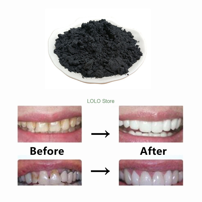 مسحوق فحم نقي ، مسحوق فحم منشط - مراجعة Activated Charcoal Powder وسعره